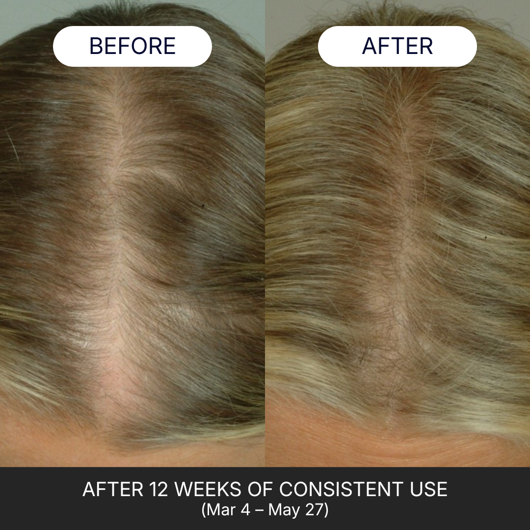 Hair Complex Gummies